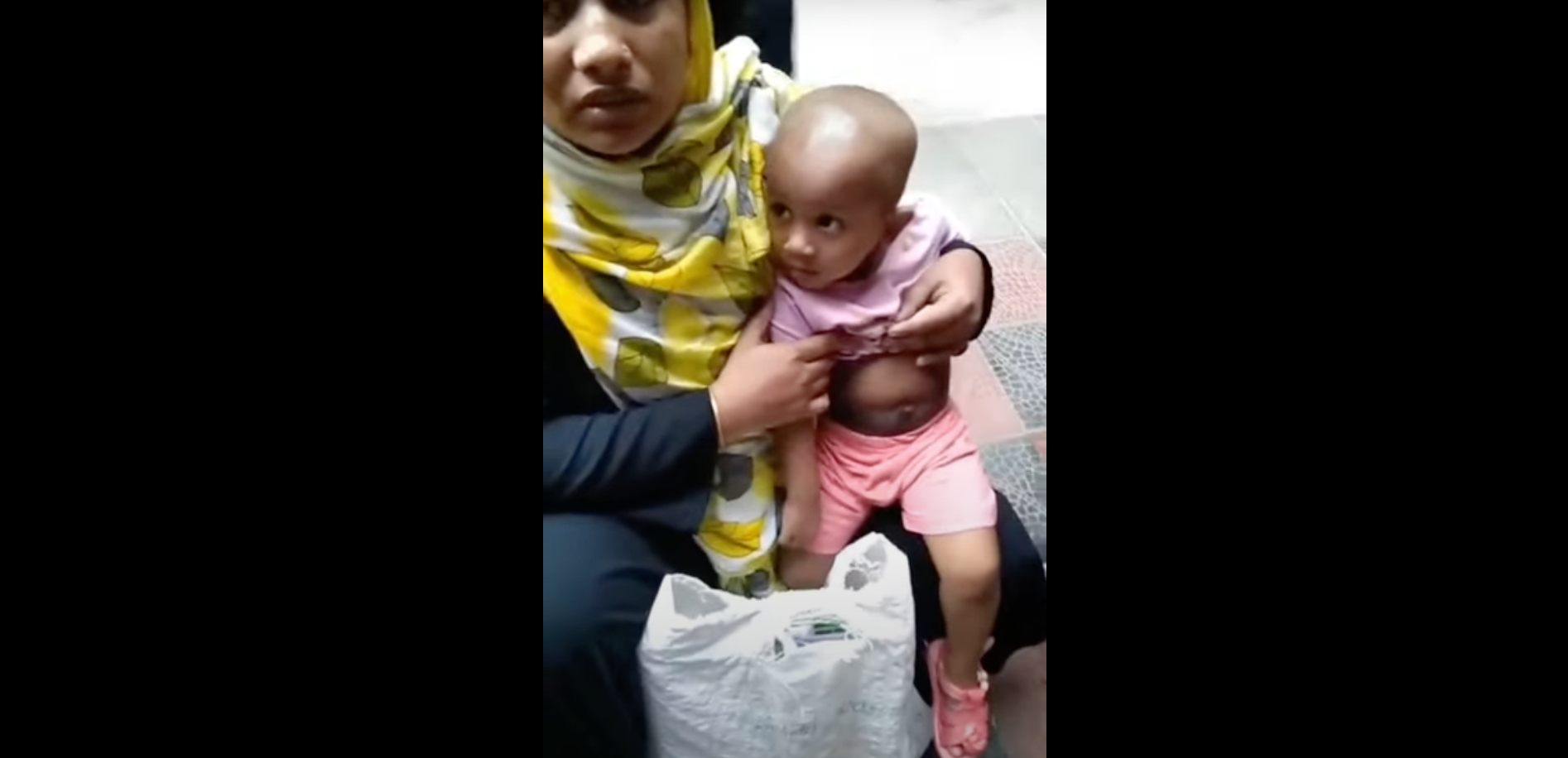 Baby With Cancer